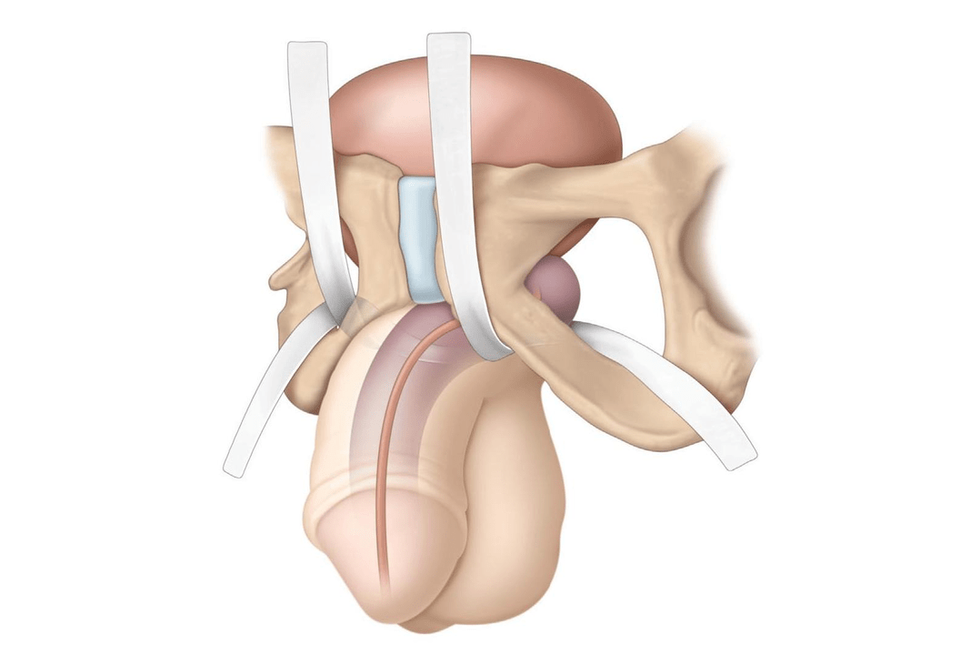 positions investigated for the presence of filler