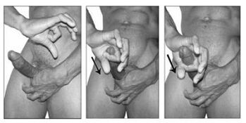 Special exercises to increase the penis