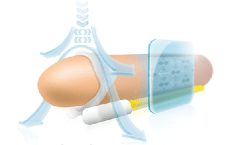 The principle of operation of the extensor to stretch the phallus in length