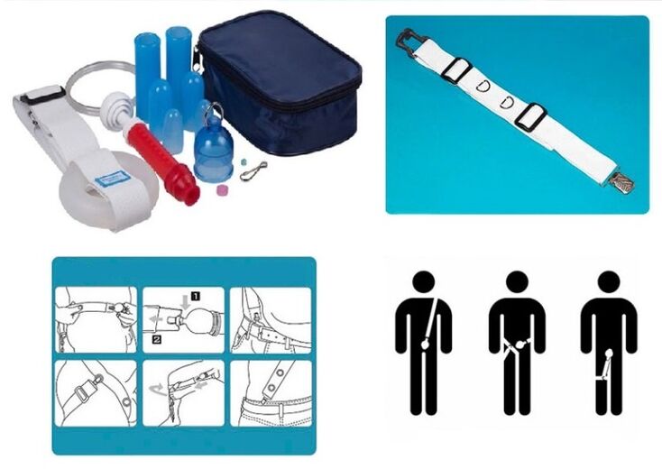 Penis lengthening and enlargement can be achieved with a stretcher